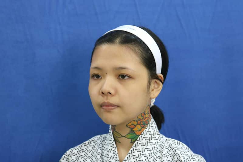 在「蜜絲歐妮診所」隆鼻，展現更精緻的自信