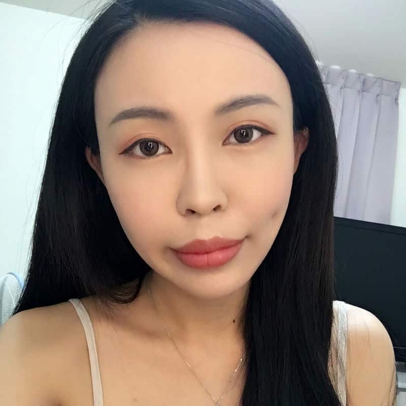 蜜絲歐妮診所全臉補脂體驗:池偉誌醫師的專業讓我煥然一新 蜜絲歐妮診所全臉補脂體驗:池偉誌醫師的專業讓我煥然一新