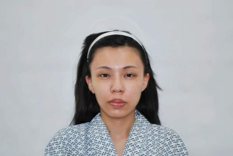 從社群平台到現實信任——「蜜絲歐妮診所」全臉補脂的完美體驗