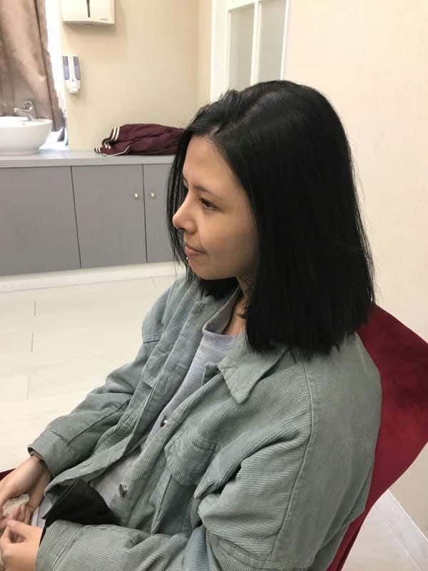 從大學朋友的推薦到親身體驗，「蜜絲歐妮診所」讓我找到自信的鼻