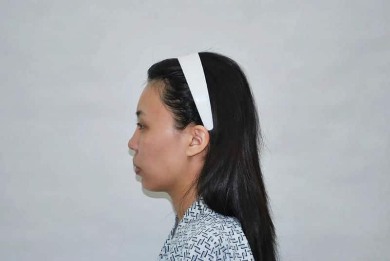 「蜜絲歐妮診所」全臉補脂經驗分享：提升五官精緻度的關鍵選擇