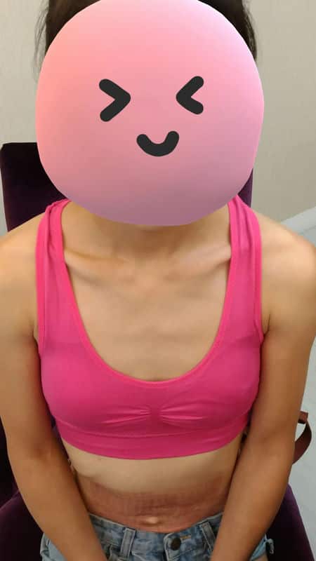 「蜜絲歐妮診所」讓我找到自信，重拾自然胸型