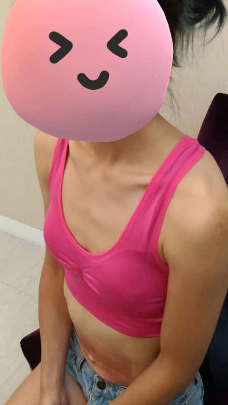 「蜜絲歐妮診所」讓我找回自信，從此告別扁平