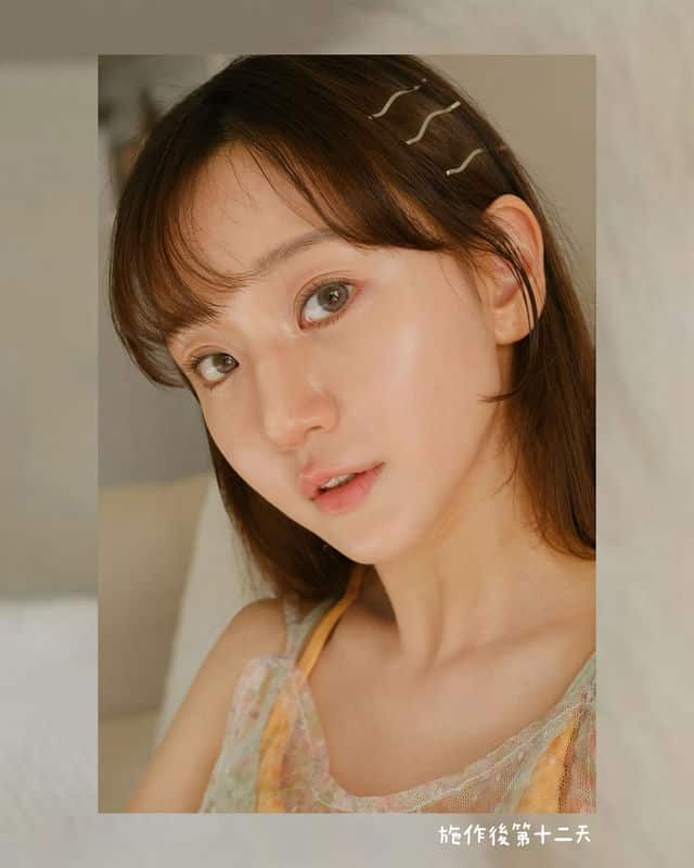 蜜絲歐妮水光注射：喚醒肌膚光采，煥然一新