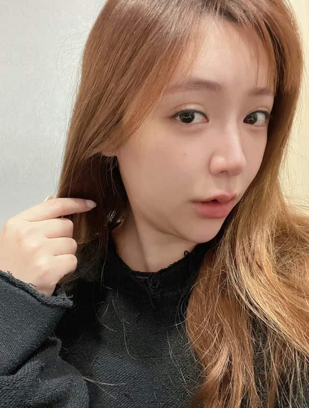 「蜜絲歐妮診所」的天鵝頸手術體驗