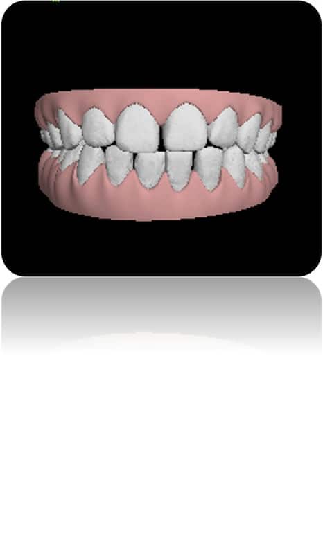嘉貝牙醫：兒童牙齒矯正的首選診所