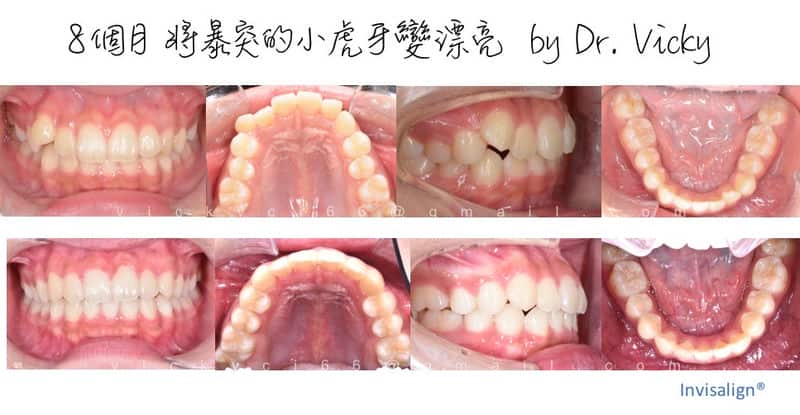 嘉貝牙醫：給孩子一個健康自信的微笑